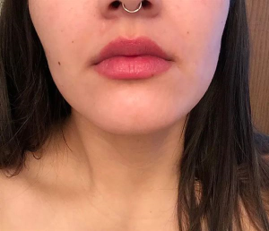 Click to view full screen GlowSilk™ IPL Laser Hair Removal Handset photo review