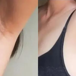 GlowSkins™ IPL Laser Permanent Hair Removal