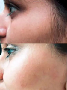 Click to view full screen GlowSilk™ IPL Laser Hair Removal Handset photo review