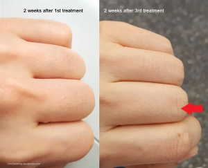 Click to view full screen GlowSilk™ IPL Laser Hair Removal Handset photo review