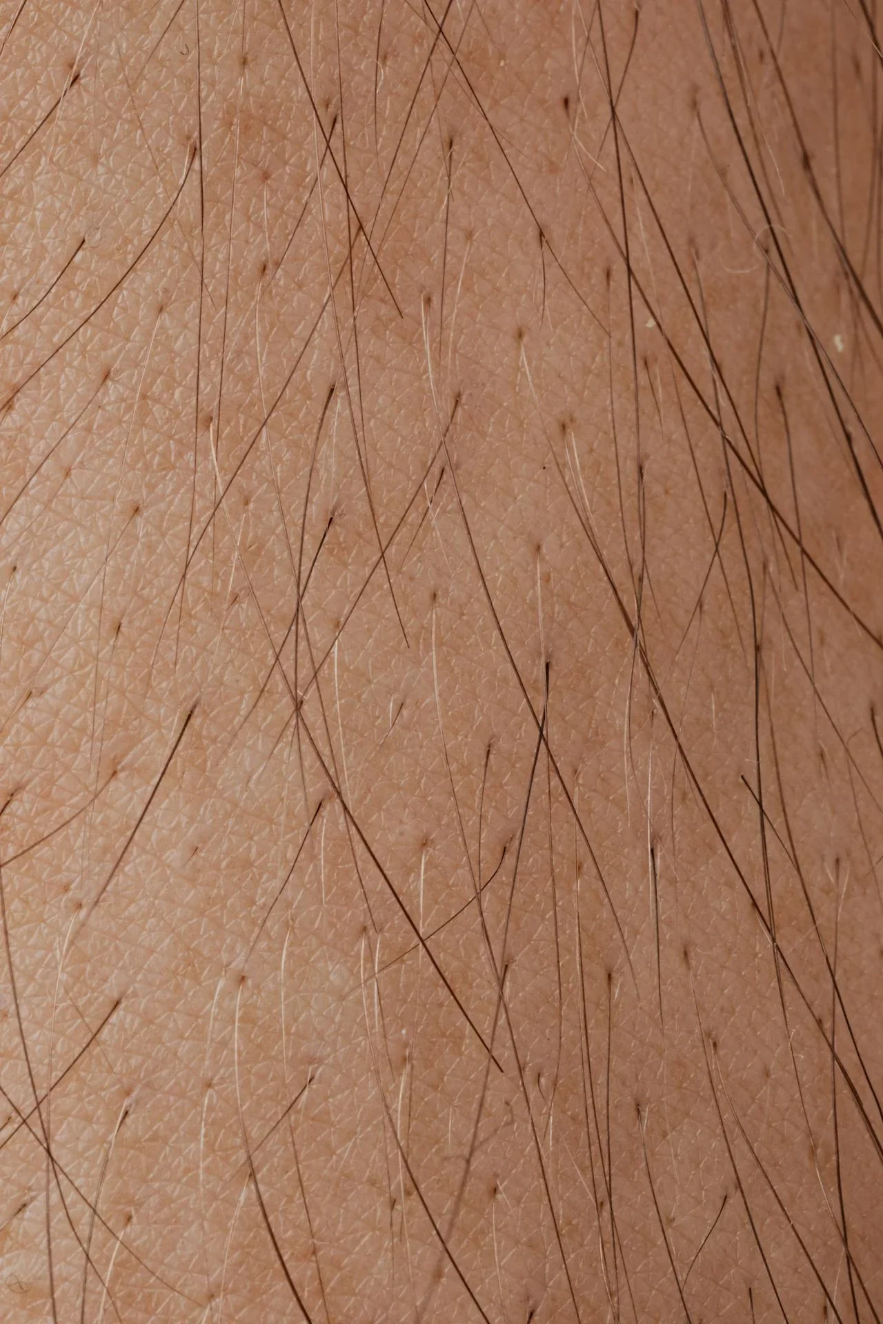 Pexels glowsilk ipl before