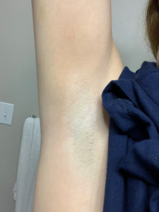 Click to view full screen GlowSilk™ IPL Laser Hair Removal Handset photo review