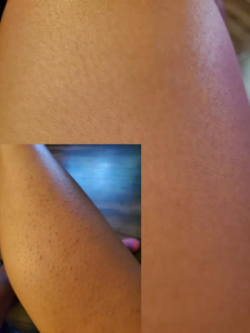 GlowSilk™ IPL Laser Hair Removal Handset photo review