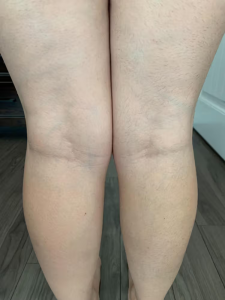 Click to view full screen GlowSilk™ IPL Laser Hair Removal Handset photo review