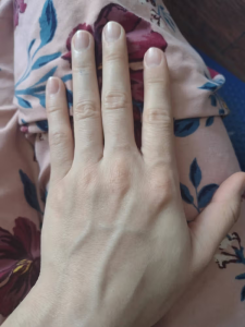 GlowSilk™ IPL Laser Hair Removal Handset photo review