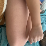 GlowSkins™ IPL Laser Permanent Hair Removal