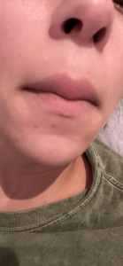 Click to view full screen GlowSilk™ IPL Laser Hair Removal Handset photo review