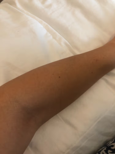 GlowSilk™ IPL Laser Hair Removal Handset photo review