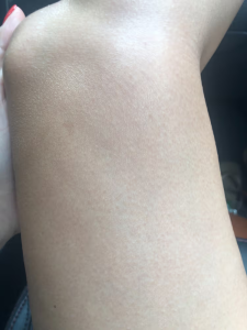 Click to view full screen GlowSilk™ IPL Laser Hair Removal Handset photo review